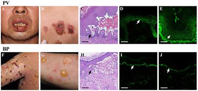 Frontiers | Role Of Regulatory Immune Cells And Molecules In Autoimmune ...